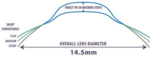 Schematische voorstelling hybride contactlenzen