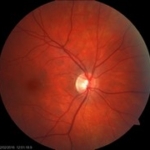 Fundus foto, fotografie (JGK 2016)