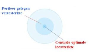 Schematische opbouw multifocale hybridelens