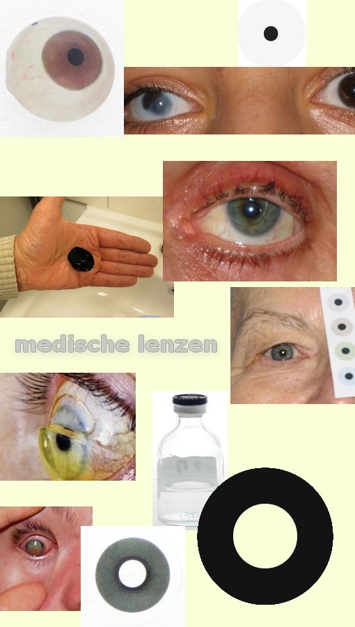 Banner-medische-lenzen